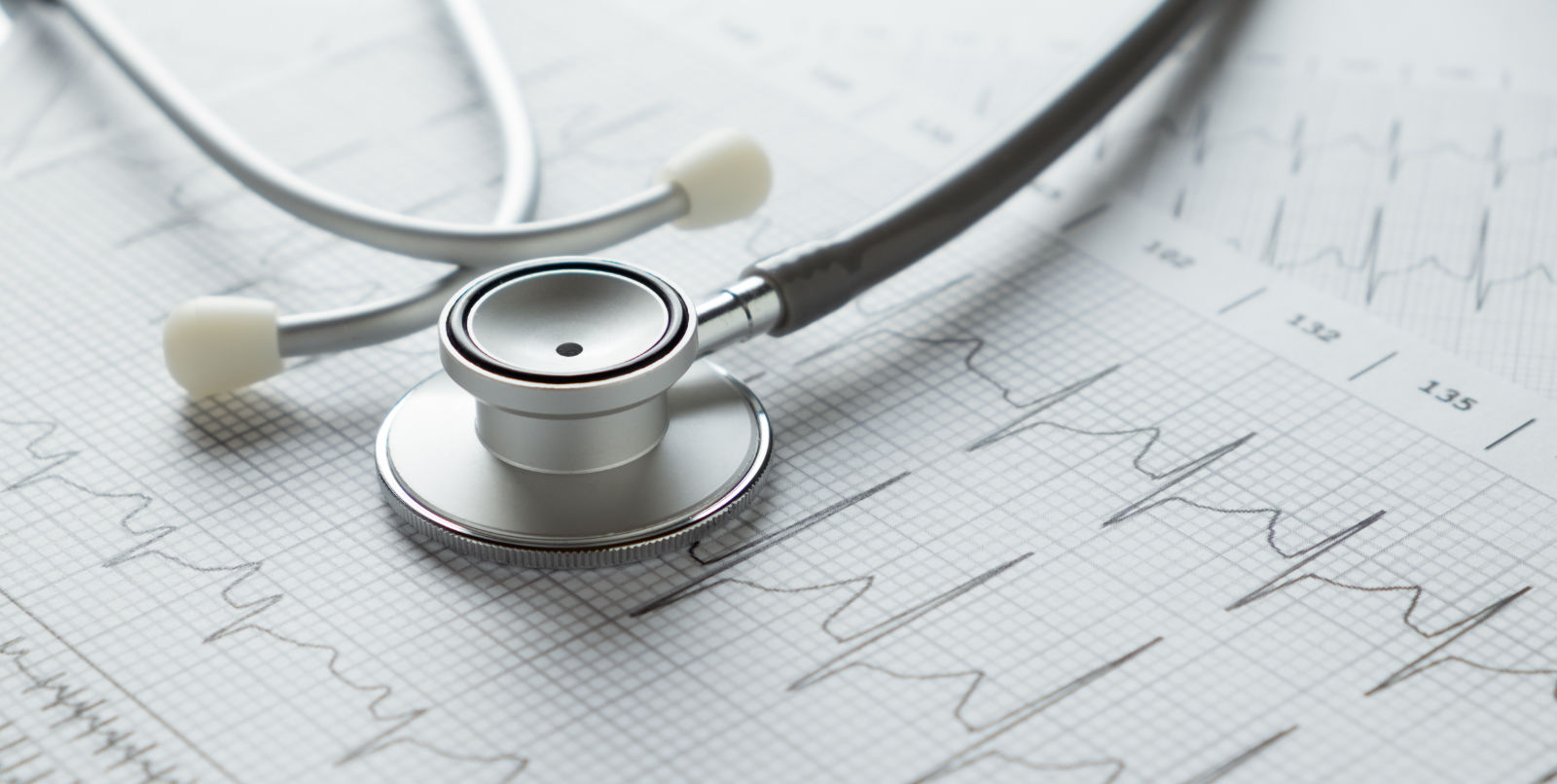 Cardioversie