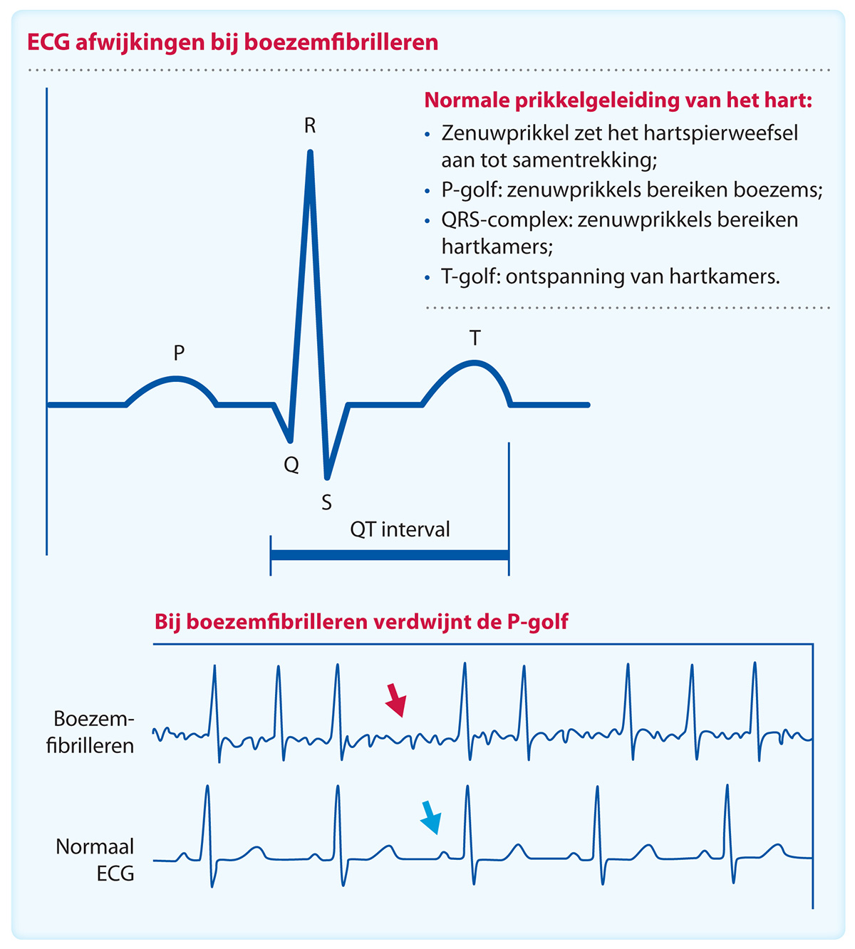 hartprobleem-holteronderzoek-diagnose-ecg